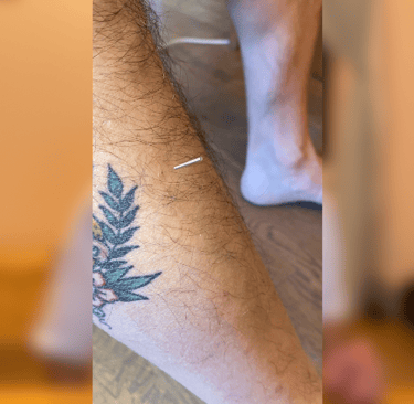 pic shows acu needle in shin muscle, Stomach 36. An american traditional tattoo reads "Heather"
