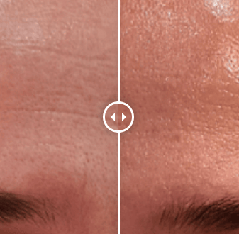 Avant, Après soins visage