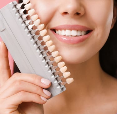 A smiling woman holding a tooth shade comparison model next to her mouth.