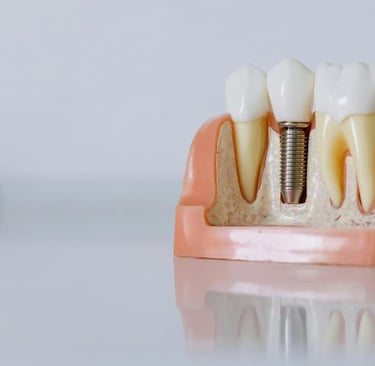 implante dental badajoz