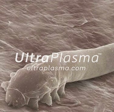 demodex_tedavi_treatment_ultra_plasma_ultra_plazma_ultra-plasma_ultra-plazma