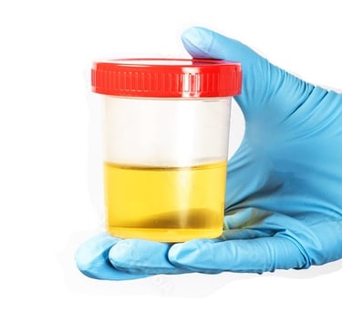 Urinary Tract Infection, Burning, Pee, Urine, Frequency, Antibiotics, Tests, Testing, UTI
