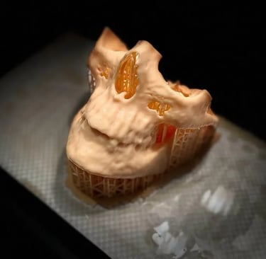 3D printed maxillofacial model