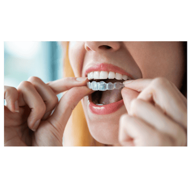 ortodoncia con invisalign en gran canaria