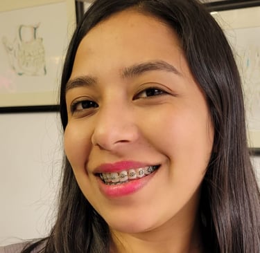 Sonrisa perfecta después de ortodoncia en DUPRINS Lima - Brackets y alineadores dentales