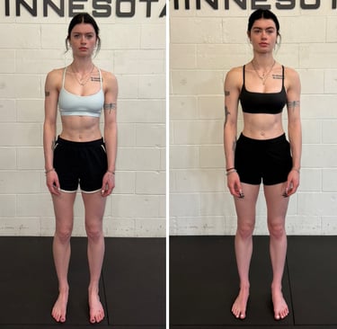 woman with scoliosis showing improved posture and less pain in after pic vs before training