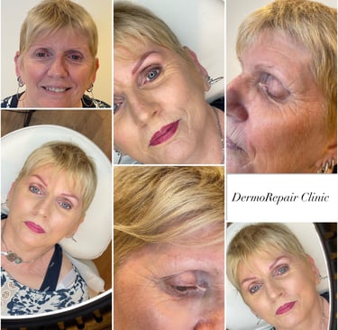 Avant et aprés dermopigmenetation sourcils femme Sedan Ardennes 08 