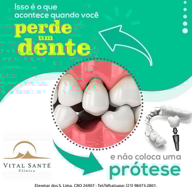Perda de um dente