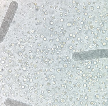 urina vista do microscopio com cilindros urinarios