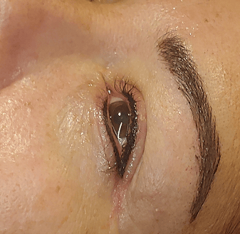 Smudge-proof upper and lower eyeliner tattoo