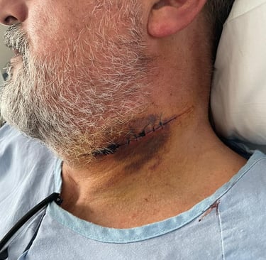 Detalle de secuelas en cuello de Andrés Román en Gandía que se relatan en la novela Sin lealtad, la