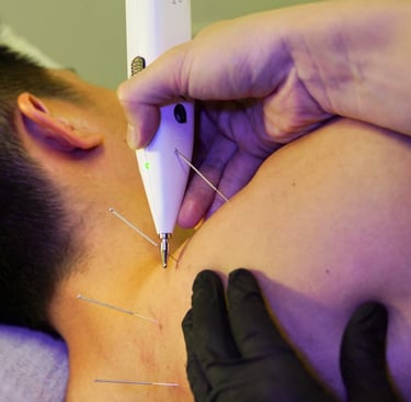 Electrical Dry Needling (EDN) useful for chronic muscular conditions
