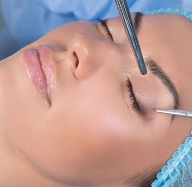 Mulher de olhos fechados em centro cirúrgico aguardando a cirurgia plástica de pálpebras