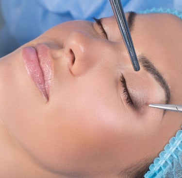 Mulher de olhos fechados em centro cirúrgico aguardando a cirurgia plástica de pálpebras