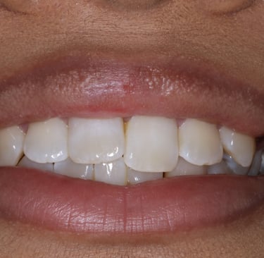 pictures of teeth