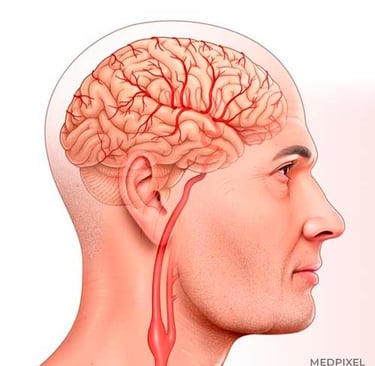 ilustracao medica neuroanatomia mostrando arteria carotida interna comum e cerebro