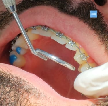 Tratamiento dental para adultos en Badajoz