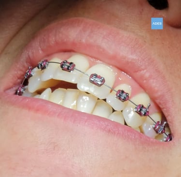 Revisión de ortodoncia en Clínica Dental ADES
