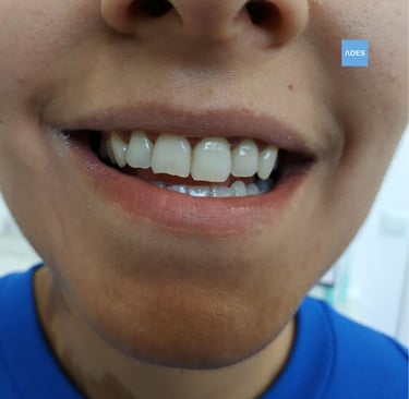 clinica dental ades ortodoncia infantil