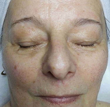 Neuro Cannabis kezelés eredménye veszprém