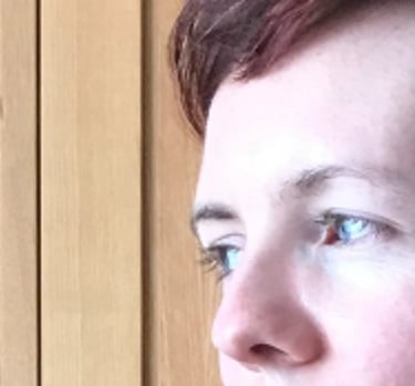 White trans masc nonbinary person in early medical transition