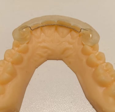 Fixed Bonded Retainer with 3D printed fitting jig