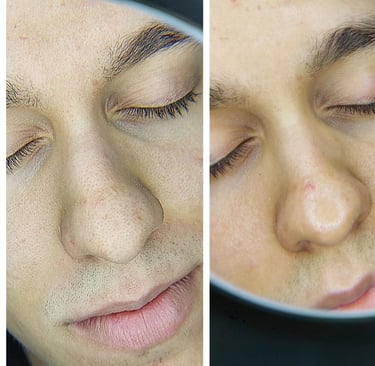 Férfi arckezelés Veszprém