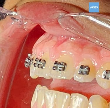 Sala de ortodoncia en Clínica Dental ADES