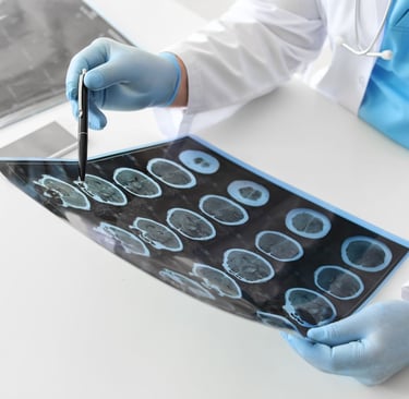 Neurologista em Ribeirão Preto SP