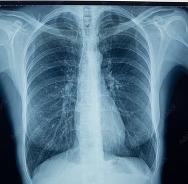 Fracture, Bone, Broken, Pneumonia, Cancer, Mass, Something hurts, X Ray