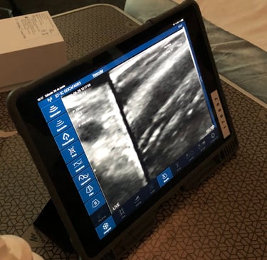 Taller para aprender el manejo de una sonda lineal biplano