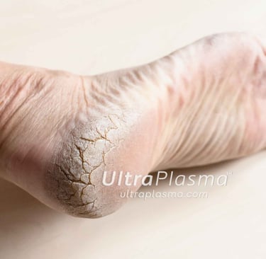 ultra_plasma_ultra_plazma_ultra-plasma_ultra-plazma