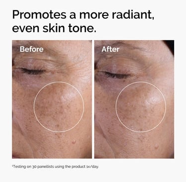 Before and after photo showing reduced pigmentation and more even, radiant skin tone around the eye 