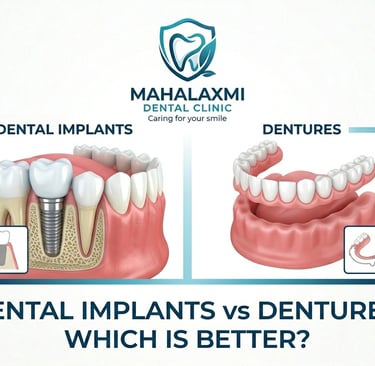 Dental Implants Vs Dentures