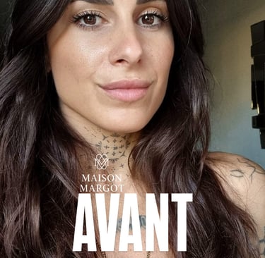 Avant sans taches de rousseur 