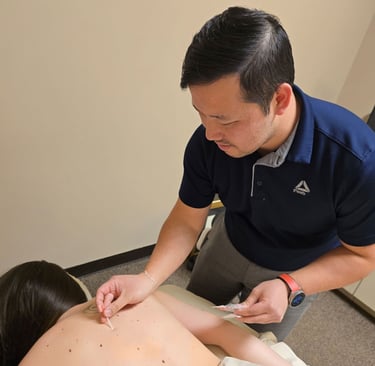 Dr. Xiong performing acupuncture treatment for back pain at Balance Naturopathic & Acupuncture.