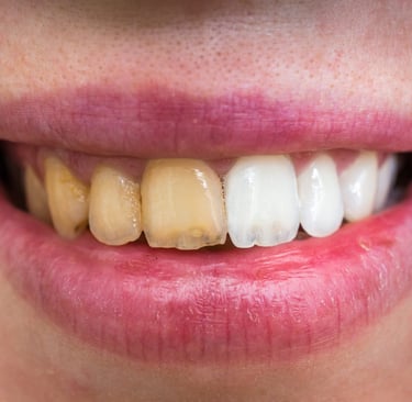 teeth cleaning near me