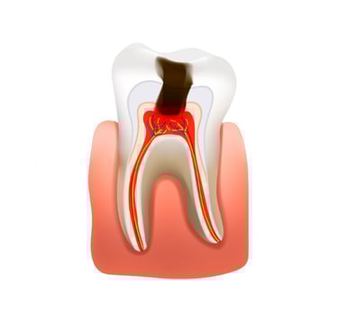 tooth removal in baner