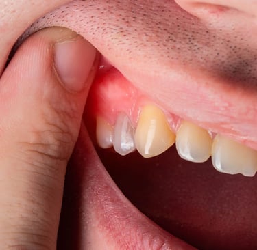 gum dental solution near me