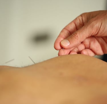 acupuntor insertando una aguja en la espalda