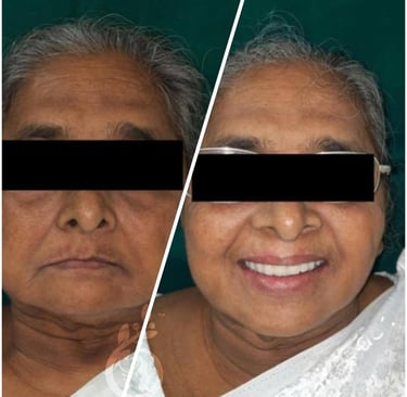 Olīva Dental - Complete Dentures