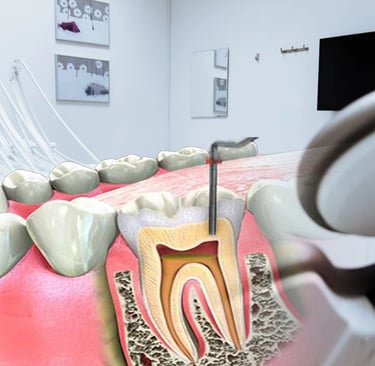 classificação dos canais radiculares endodontia resumo
