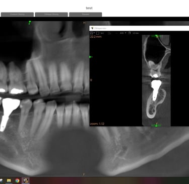 CBCT Scan 