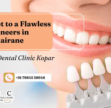 Dental Veneers in Kopar Khairane | Ekdantam Dental Clinic kopar kharine