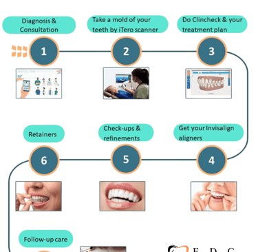 The Step-by-Step Process of Getting Clear Aligners | Ekdantam Dental Clinic Navi Mumbai
