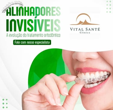 invisalign aparelho invisível