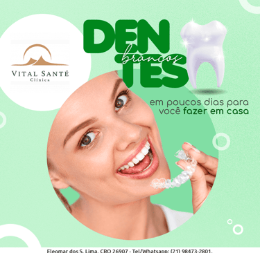 Clareamento caseiro