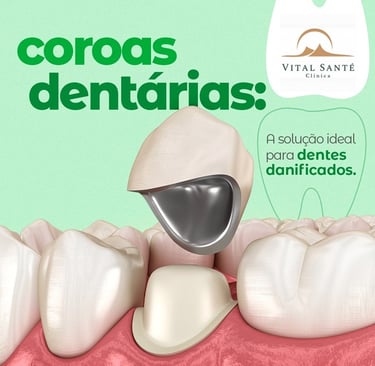 prótese dentária recreio