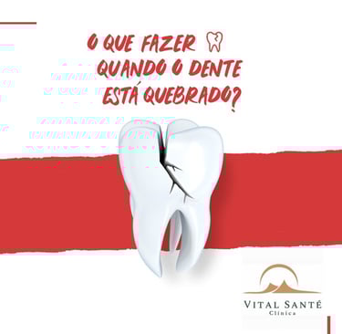 dente quebrado dentista recreio