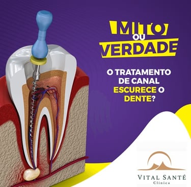 tratamento de canal no Recreio